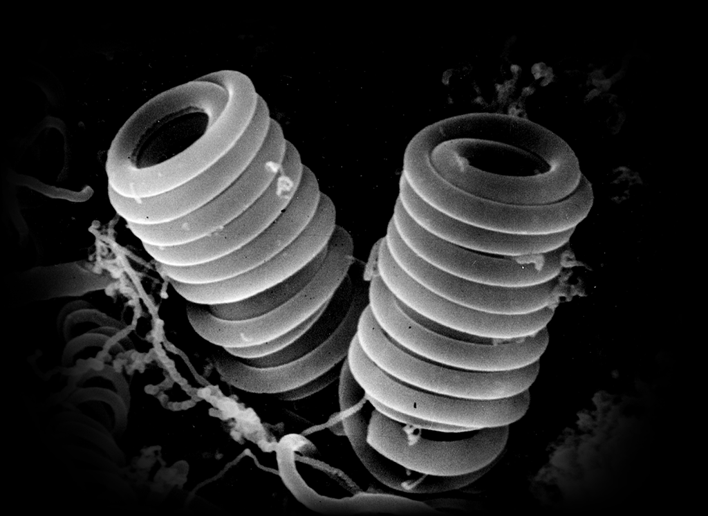 メインビジュアル：カーボンマイクロコイル(CMC)